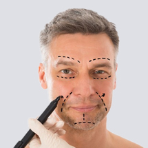 Men Fractional RF for Face Lifting, Acne Scar and Rejuvenation